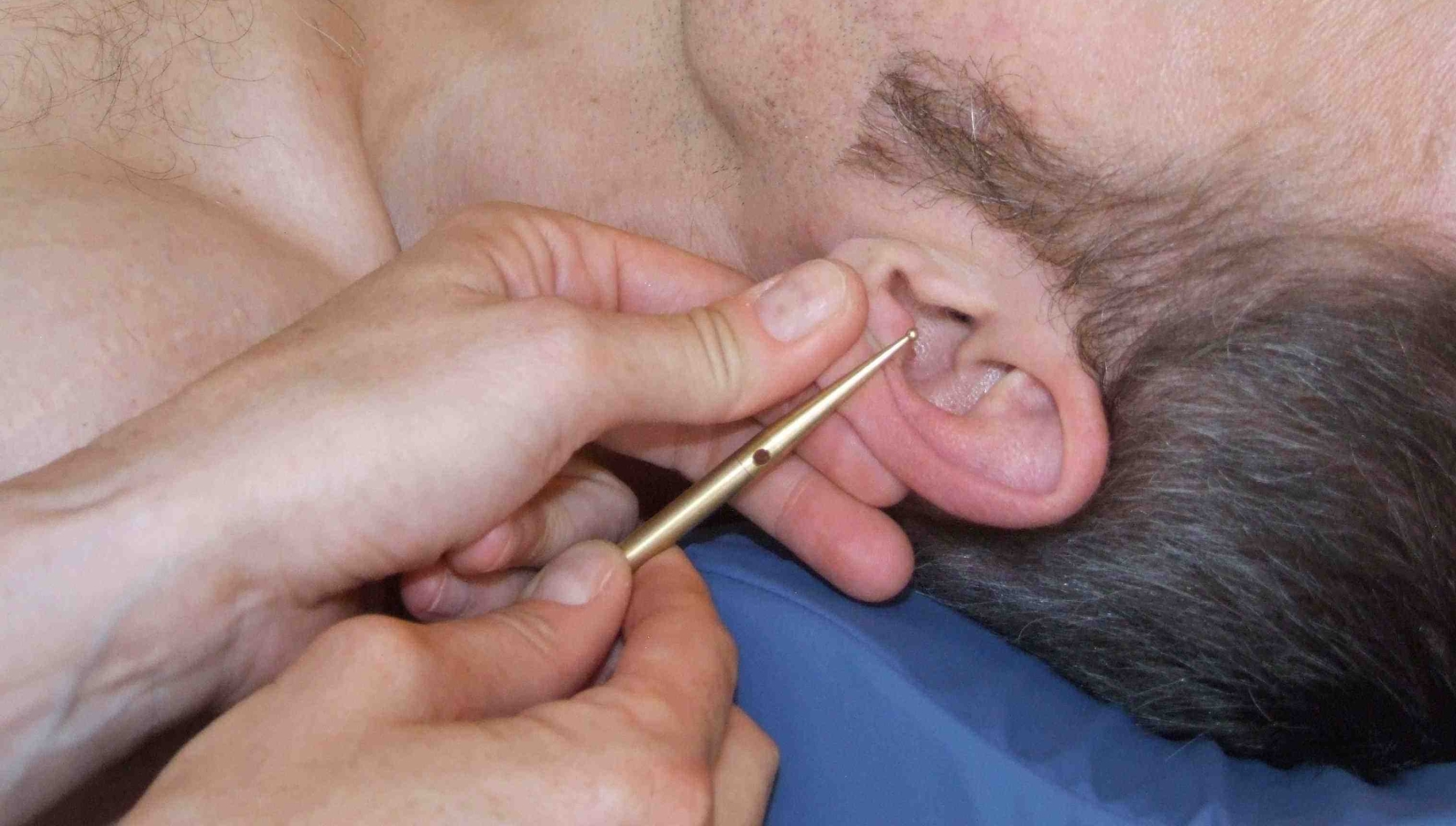 akupunktur-massage-apm-radloff-ohrbefund